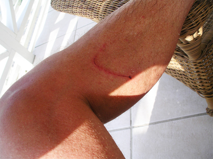 That must have hurt!!!!!.